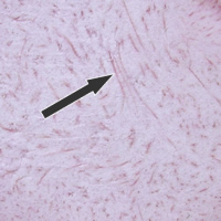 pink fiber Pink fibers