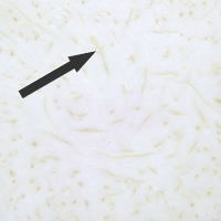 white fiber Yellow fibers
